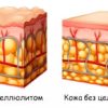 Банки вакуумные массажные для тела, РОЗОВЫЕ — изображение 8