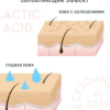 Пилинг для лица Lactic acid 11% всесезонный Ph 3,2-3,6 алоэ, 30мл EVSI — изображение 3