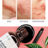 Пилинг для лица Black Peel всесезонный Ph 4 Шунгит, уголь бамбука, ниацинамид, 30мл EVSI (Копировать) — изображение 7