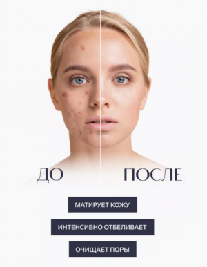 Пилинг для лица сухой Nicotinic and Kojic acid, 100мл EVSI - Image 5